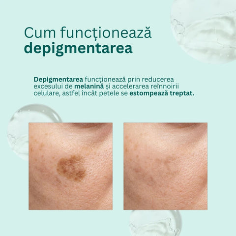 Cremă depigmentantă Lumière cu Melavoid și acid kojic pentru pete maronii, 50 ml